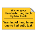 Warnung vor Handverletzung durch /.../ - Warning of hand injury due to /.../